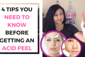 Do Acid peels work?4 Tips You NEED to Know BEFORE Getting an Acid Peel!
