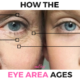 ANTI AGING TIP: How to Treat Dark Circles Around the Eyes, Bags Under Eyes, Saggy Eyelids