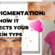 Hyperpigmentation:  Understanding How it Affects your Skin Type