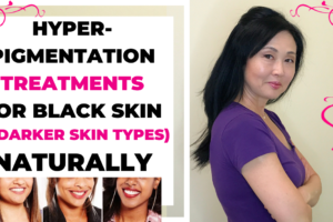 Hyperpigmentation Treatments for Black Skin (and darker skin types)