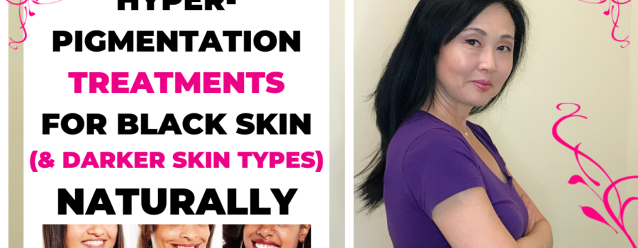 Hyperpigmentation Treatments for Black Skin (and darker skin types)