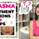 Best Treatment Options for Melasma