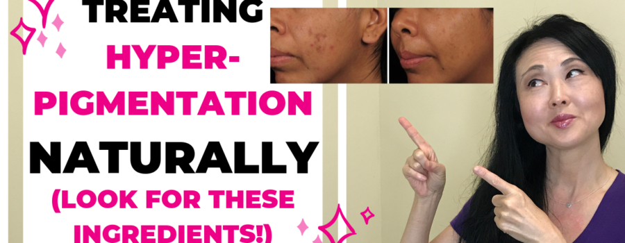 Treating Hyperpigmentation Naturally (Look for these ingredients)