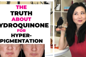 Hydroquinone for Hyperpigmentation