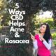 5 WAYS CBD HELPS HEAL ACNE AND ROSACEA