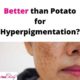 Better than Potatoes for Hyperpigmentation